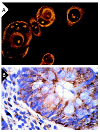 NF2, sc-331.     MCF7,   (A)        (B)